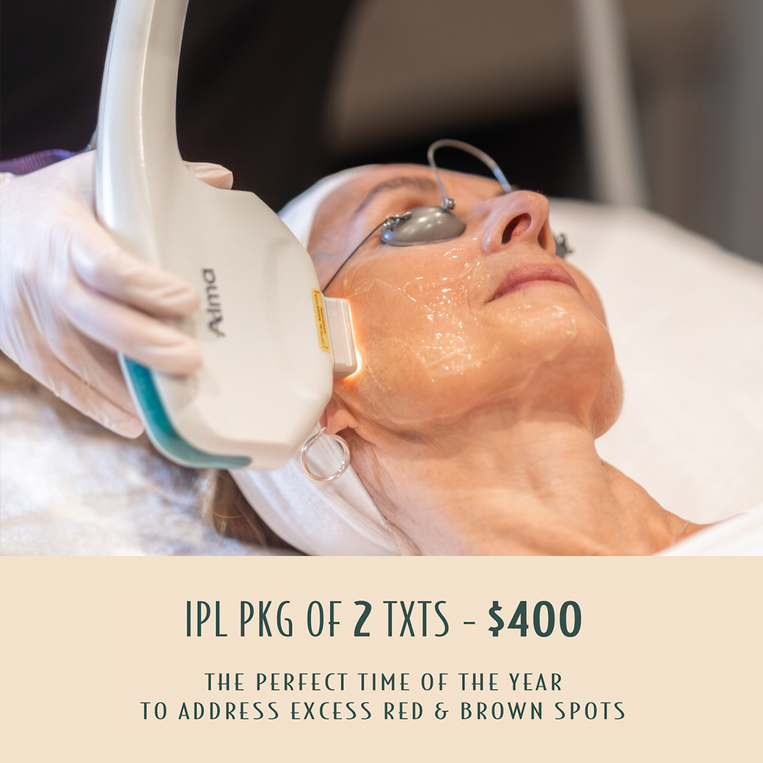 IPL Package for January