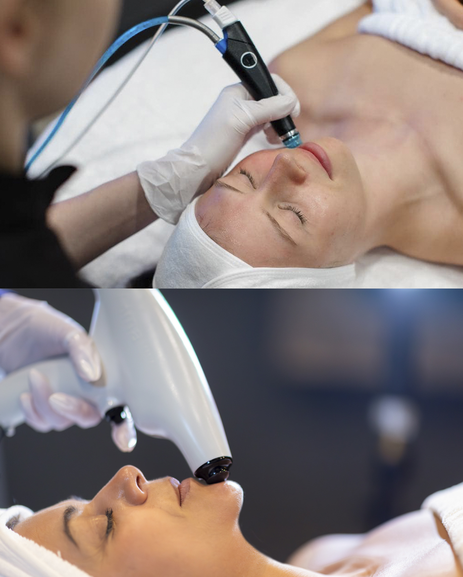 Hydrafacial + RF Skin Tightening