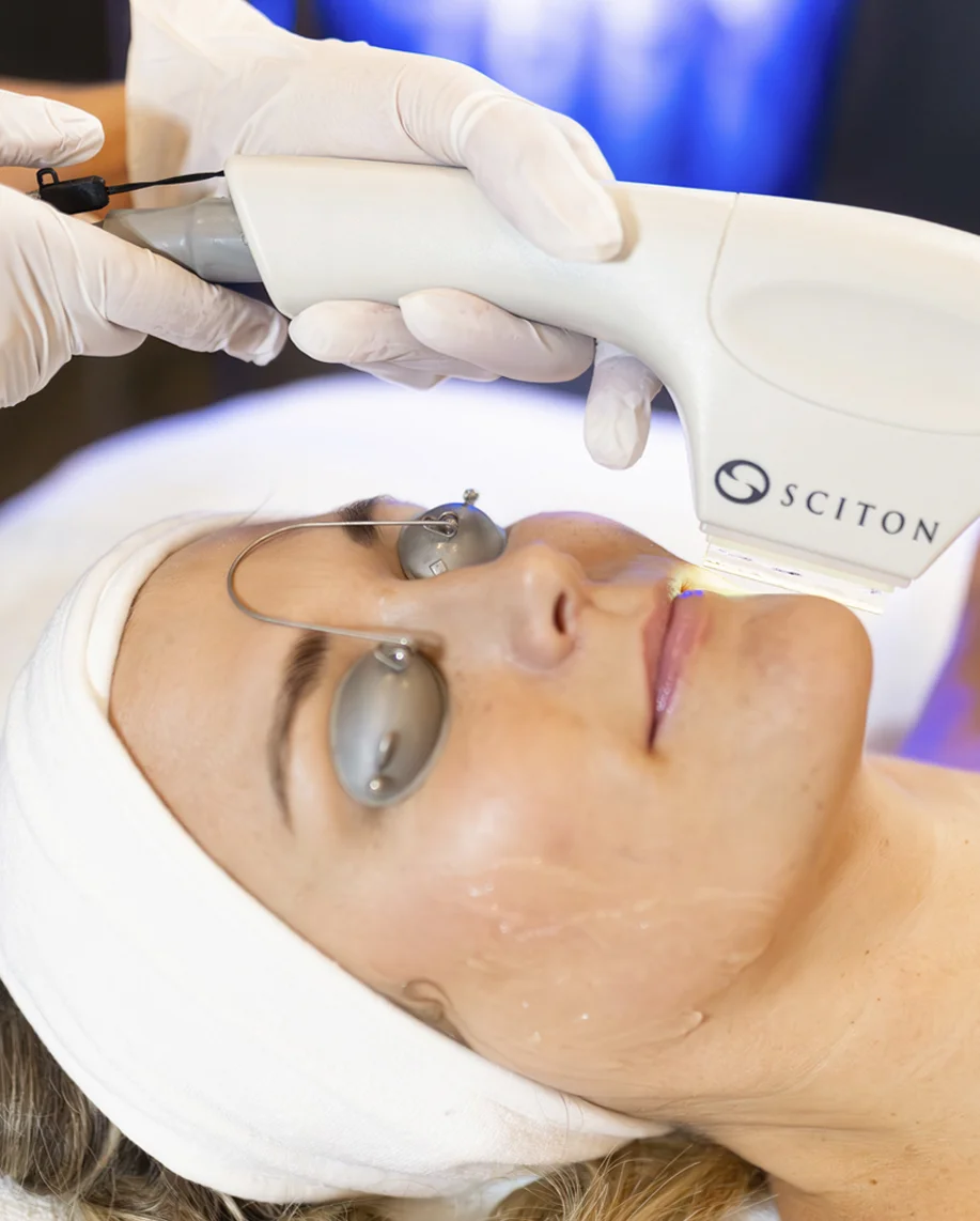 IPL treatment being performed on a client