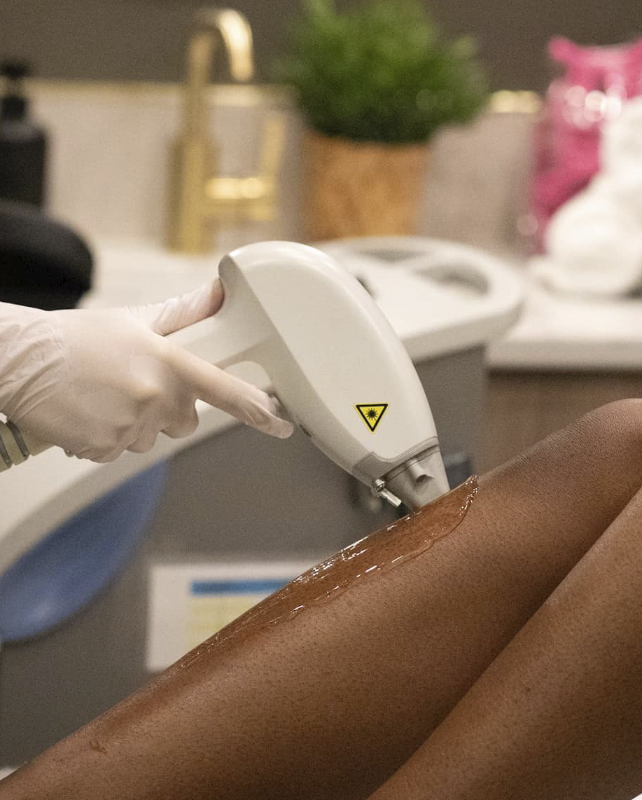 Laser Hair Removal