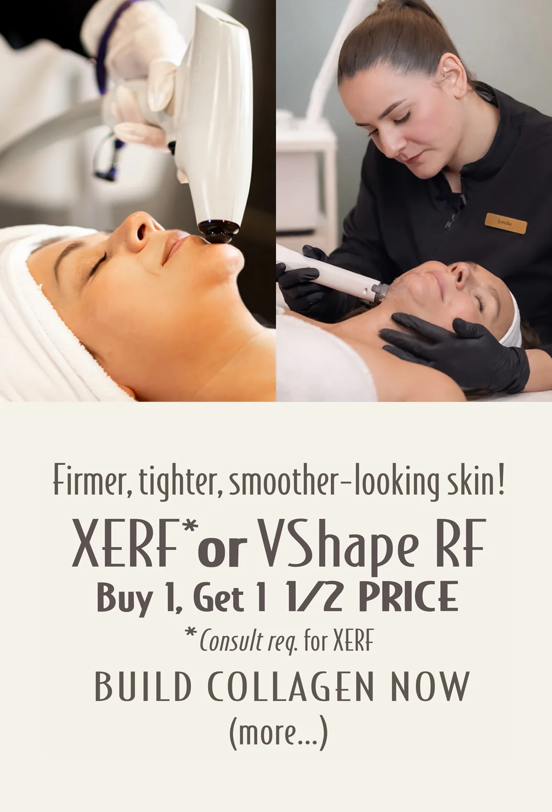 Xerf or VShape