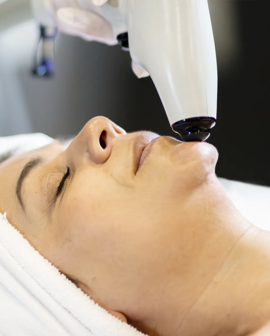 VShape Skin Tightening VShape Skin Tightening