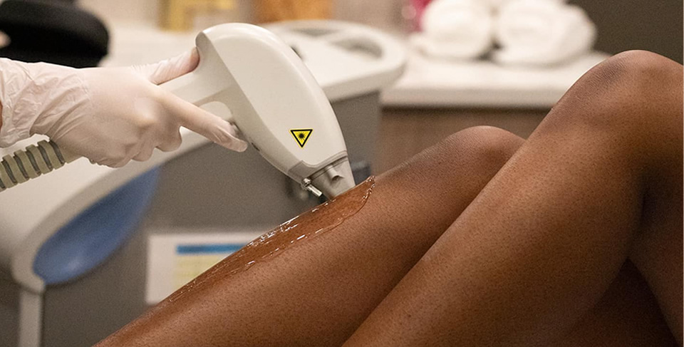 Laser Hair Removal