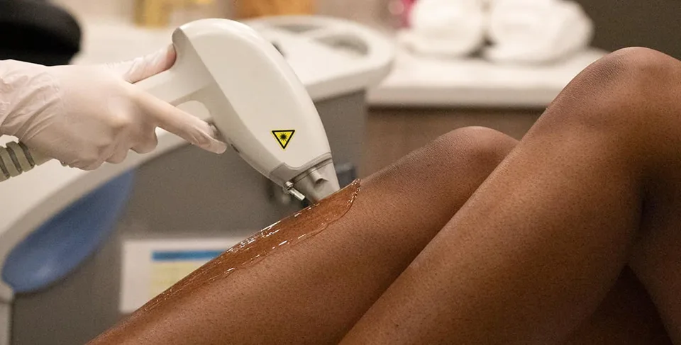 Laser Hair Removal