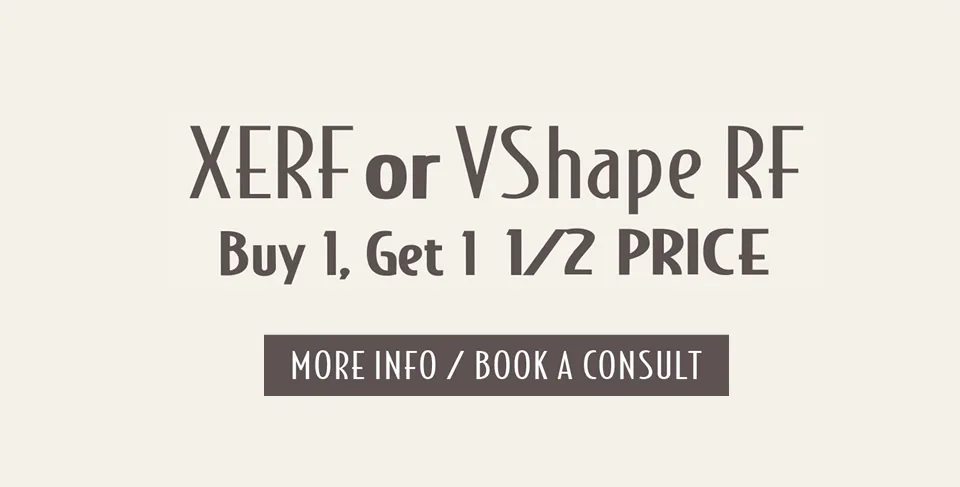 Xerf or VShape